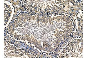 ABIN7095333 and ABIN7099390 at 1/100 staining rat testis tissue by IHC-P. (COPA Antikörper)
