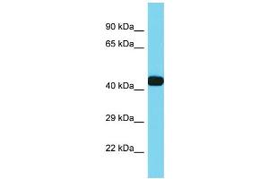 Host: Rabbit Target Name: CXorf36 Sample Type: Hela Whole cell lysates Antibody Dilution: 1. (CXORF36 Antikörper  (C-Term))