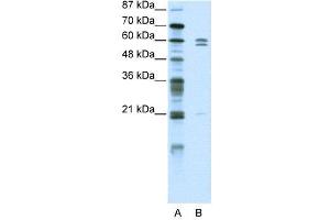 WB Suggested Anti-ZNF312  Antibody Titration: 5. (FEZF2 Antikörper  (C-Term))