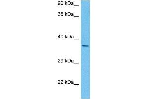 Host:  Mouse  Target Name:  PITX2  Sample Tissue:  Mouse Brain  Antibody Dilution:  1ug/ml (PITX2 Antikörper  (N-Term))