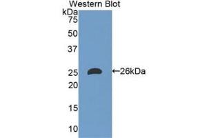 Western blot analysis of the recombinant protein. (Apolipoprotein M Antikörper)
