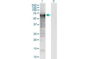 Western Blot analysis of PLS3 expression in transfected 293T cell line by PLS3 monoclonal antibody (M01), clone 5B9.
