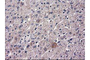 Immunohistochemical staining of paraffin-embedded Human liver tissue using anti-HAO1 mouse monoclonal antibody. (HAO1 Antikörper)