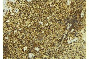 ABIN6276911 at 1/100 staining Mouse pancreas tissue by IHC-P. (NR0B2 Antikörper  (Internal Region))