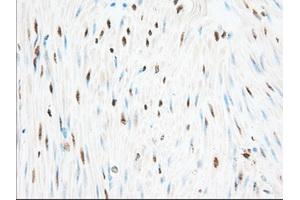Immunohistochemical staining of paraffin-embedded Human pancreas tissue using anti-H6PD mouse monoclonal antibody. (Glucose-6-Phosphate Dehydrogenase Antikörper)