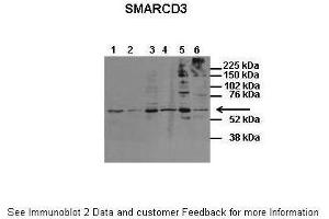Host:  Rabbit  Target Name:  SMARCD3  Sample Type:  Human Fetal Brain  Antibody Dilution:  1. (SMARCD3 Antikörper  (N-Term))