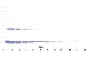 Image no. 1 for anti-Interleukin 1 alpha (IL1A) antibody (ABIN465408) (IL1A Antikörper)