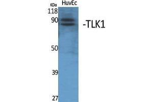 Western Blotting (WB) image for anti-Tousled-Like Kinase 1 (TLK1) (Internal Region) antibody (ABIN3187282) (TLK1 Antikörper  (Internal Region))