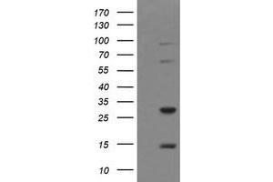 Image no. 2 for anti-Tripartite Motif Containing 38 (TRIM38) (AA 1-265) antibody (ABIN1490686)