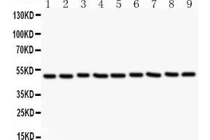 Anti-CSK Picoband antibody, All lanes: Anti CSK  at 0. (CSK Antikörper  (AA 2-204))