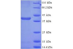 SDS-PAGE (SDS) image for SCO2 Cytochrome C Oxidase Assembly Protein (SCO2) (AA 43-266) protein (His-SUMO Tag) (ABIN5710316) (SCO2 Protein (AA 43-266) (His-SUMO Tag))