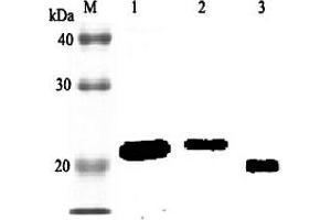 Western blot analysis using anti-RBP4 (rat), pAb  at 1:2'000 dilution. (RBP4 Antikörper)