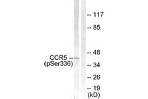 Western blot analysis of extracts from Jurkat cells, using CCR5 (Phospho-Ser336) Antibody. (CCR5 Antikörper  (pSer336))