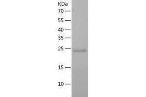 PSMA2 Protein (AA 1-234) (His tag)