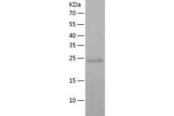 PSMA2 Protein (AA 1-234) (His tag)