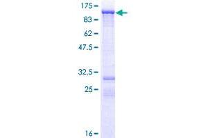 MARK3 Protein (AA 1-729) (GST tag)