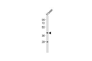 Anti-CNR2 Antibody (N-term) at 1:2000 dilution + human brain lysates Lysates/proteins at 20 μg per lane. (CNR2 Antikörper  (N-Term))