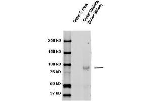 ENaC beta, rat kidney tissue. (SCNN1A Antikörper  (AA 617-638))