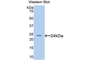 Western Blotting (WB) image for anti-Afamin (AFM) (AA 210-403) antibody (ABIN1077755) (Afamin Antikörper  (AA 210-403))