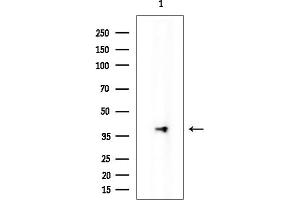 anti-N-Myc (And STAT) Interactor (NMI) antibody
