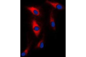 Immunofluorescent analysis of MAST2 staining in HeLa cells. (MAST2 Antikörper  (Center))