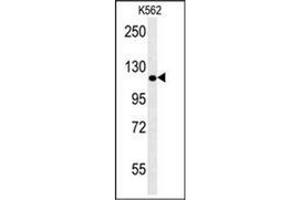 Western blot analysis of POTEE Antibody (Center) in K562 cell line lysates (35ug/lane). (POTEE Antikörper  (Middle Region))