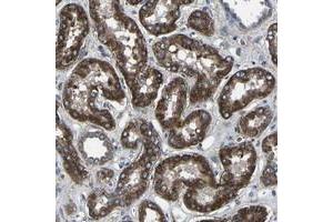 Immunohistochemical staining of human kidney with KIAA1958 polyclonal antibody  shows strong cytoplasmic positivity tubular cells. (KIAA1958 Antikörper)
