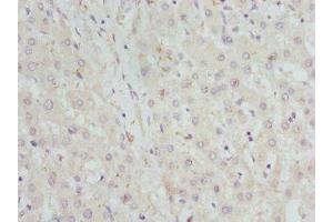 Immunohistochemistry of paraffin-embedded human liver tissue using ABIN7142066 at dilution of 1:100 (GBE1 Antikörper  (AA 1-300))