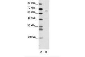 Image no. 1 for anti-Zinc Finger Protein 205 (ZNF205) (AA 31-80) antibody (ABIN202754) (ZNF205 Antikörper  (AA 31-80))