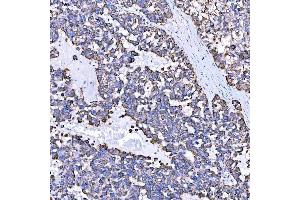 IHC analysis of SUMF2 using anti-SUMF2 antibody (ABIN7600954). (SUMF2 Antikörper  (AA 26-301))