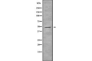 Western blot analysis of MAGAB using HepG2 whole cell lysates (MAGEA11 Antikörper  (C-Term))