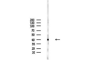 Western blot analysis of lysates from  cells(starvation,24h treatment), using ARG2 Antibody at 1/1000 dilution.