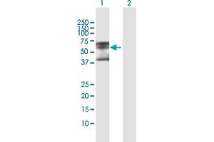 Western Blot analysis of PLA2G3 expression in transfected 293T cell line by PLA2G3 MaxPab polyclonal antibody. (PLA2G3 Antikörper  (AA 1-509))