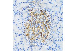 Immunohistochemistry of paraffin-embedded rat pancreatic islet using DLK1 antibody (ABIN3016512, ABIN3016513, ABIN3016514 and ABIN6219768) at dilution of 1:200 (40x lens). (DLK1 Antikörper)