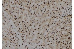 ABIN6272558 at 1/100 staining Human liver tissue by IHC-P. (TFCP2L1 Antikörper  (N-Term))