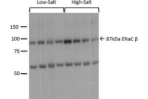 Western blot analysis of Mouse kidney cortex showing detection of ENaC protein using Rabbit Anti-ENaC Polyclonal Antibody (ABIN863203). (SCNN1A Antikörper  (AA 617-638))