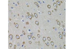 Immunohistochemistry of paraffin-embedded Rat brain using PDE1B Polyclonal Antibody at dilution of 1:100 (40x lens). (PDE1B Antikörper)