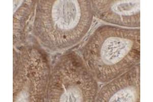Immunohistochemical analysis of SPINK2 in mouse testis tissue with SPINK2 polyclonal antibody  at 2. (SPINK2 Antikörper  (C-Term))