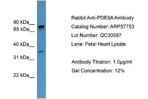 WB Suggested Anti-PDE8A  Antibody Titration: 0. (PDE8A Antikörper  (C-Term))