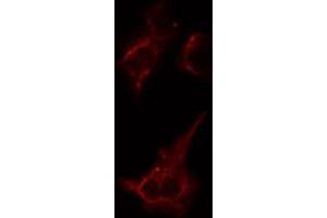 ABIN6274386 staining Hela cells by IF/ICC. (AAK1 Antikörper  (Internal Region))