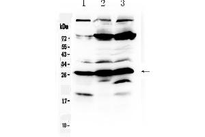 Western blot analysis of RanBP1 using anti- RanBP1 antibody . (RANBP1 Antikörper  (AA 2-201))