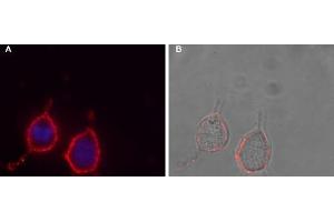 Expression of P2RY12 in human glioblastoma ( MG) cells Cell surface detection of P2RY12 in intact living  MG cells.