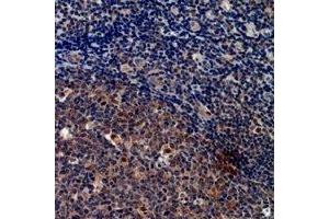 Immunohistochemical analysis of Cystatin A staining in human tonsil formalin fixed paraffin embedded tissue section. (CSTA Antikörper  (C-Term))
