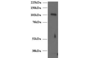 Western Blotting (WB) image for anti-Unc-13 Homolog D (UNC13D) (C-Term) antibody (ABIN2466418) (UNC13D Antikörper  (C-Term))