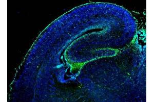 IHC-Fr Image GFAP antibody detects GFAP protein on embryonic mouse brain by immunohistochemical analysis. (GFAP Antikörper)