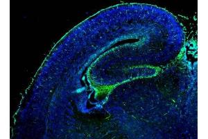 IHC-Fr Image GFAP antibody detects GFAP protein on embryonic mouse brain by immunohistochemical analysis. (GFAP Antikörper)