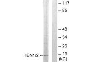 Western blot analysis of extracts from Jurkat cells, using HEN1/2 Antibody. (HEN1/2 (AA 41-90) Antikörper)