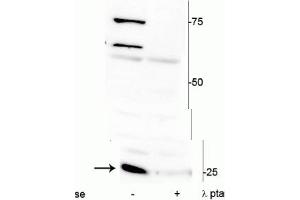 Western blot of mouse heart lysate showing specific immunolabeling of ~25 kDa cardiac troponin I protein phosphorylated at Ser150 in the first lane (-). (TNNI3 Antikörper  (pSer150))