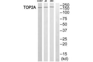 Western blot analysis of extracts from HT-29 cells, using TOP2A antibody. (Topoisomerase II alpha Antikörper  (N-Term))