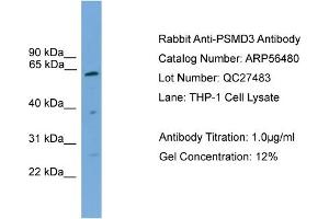 WB Suggested Anti-PSMD3  Antibody Titration: 0. (PSMD3 Antikörper  (Middle Region))